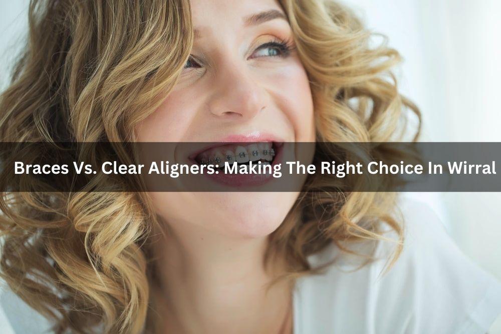 Braces Vs. Clear Aligners: Making The Right Choice In Wirral