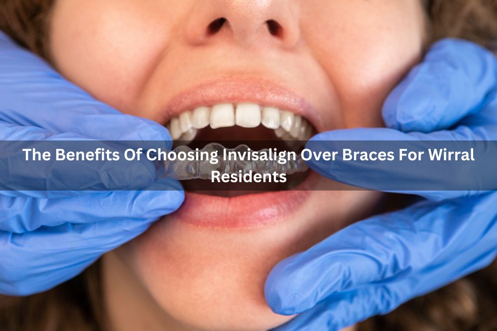The Benefits Of Choosing Invisalign Over Braces For Wirral Residents