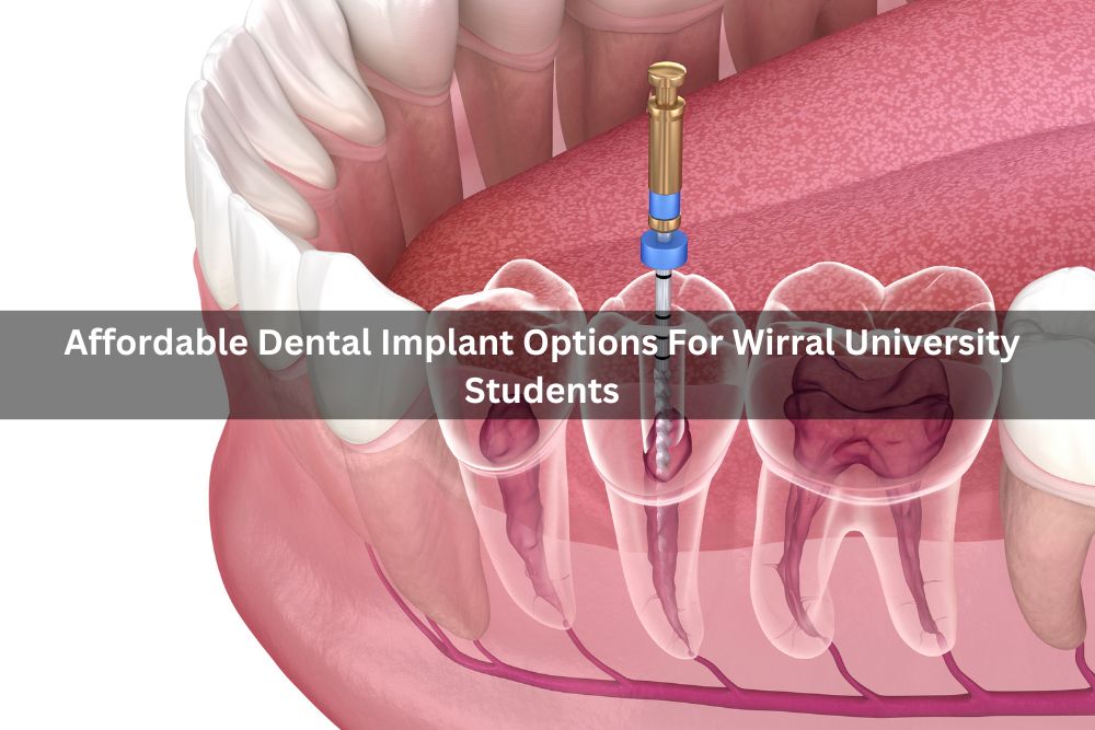 Affordable Dental Implant Options For Wirral University Students