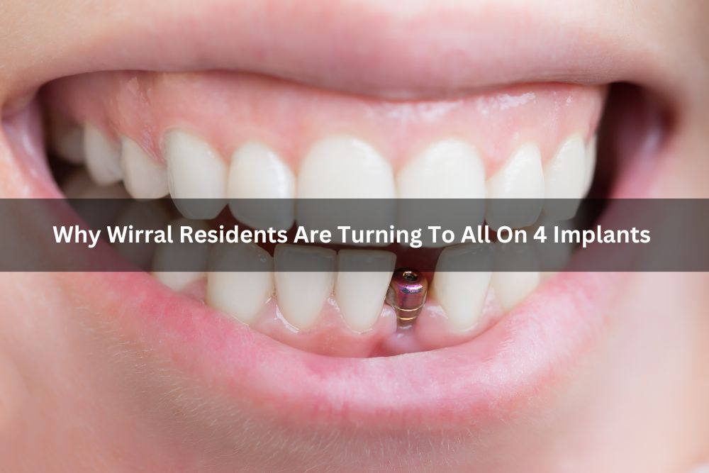 Why Wirral Residents Are Turning To All On 4 Implants