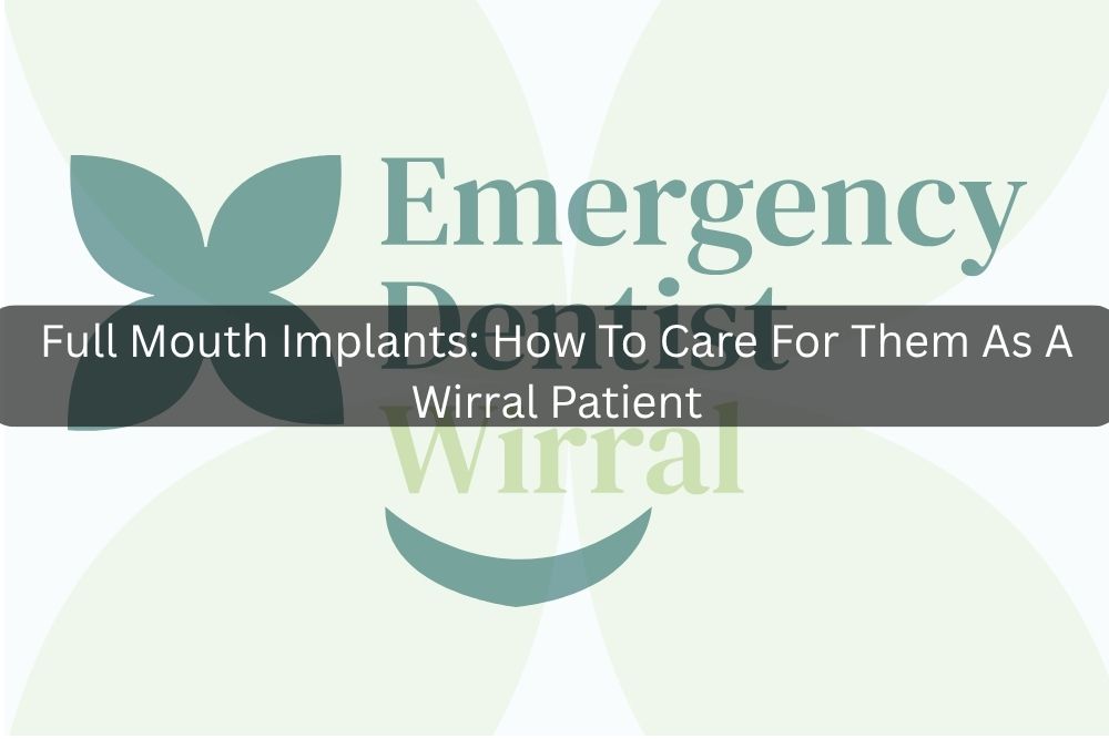 Full Mouth Implants: How To Care For Them As A Wirral Patient